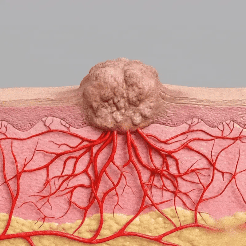 Fivfivgo® WartLift Corn Removal Liquid