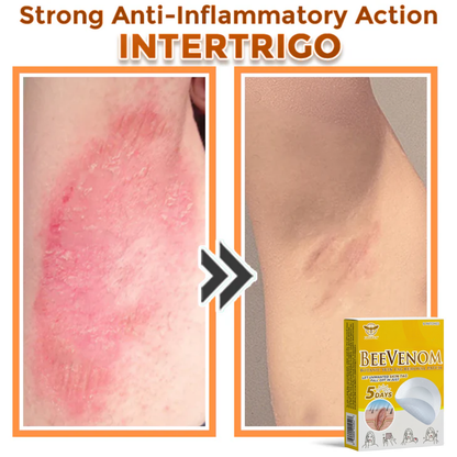 Fivfivgo® Bee Venom Botanic Skin Tag Removal Patch 🇺🇸 Made in the USA