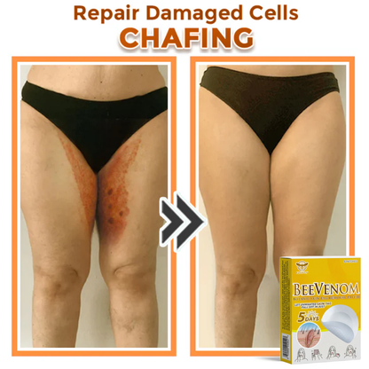 Fivfivgo® Bee Venom Botanic Skin Tag Removal Patch 🇺🇸 Made in the USA