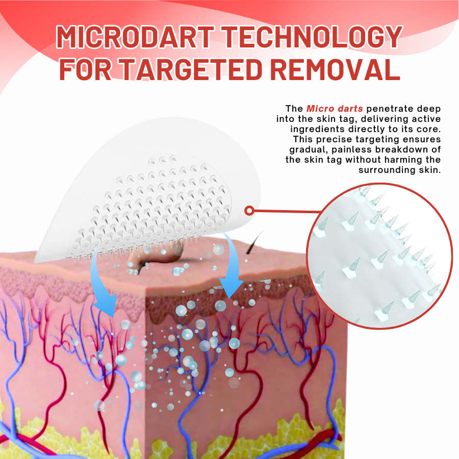 Fivfivgo™ MicroDart Skin Tag Remover Patch