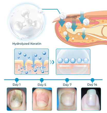 Fivfivgo™ Bee Venom Nail Fungus Treatment Solution