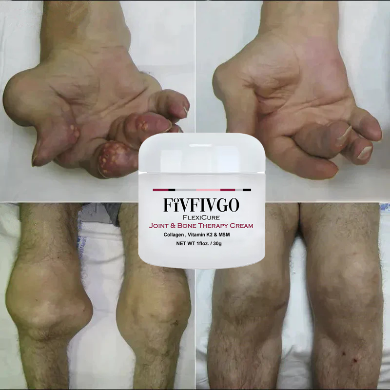 Fivfivgo™ FlexiCure Joint & Bone Therapy Cream